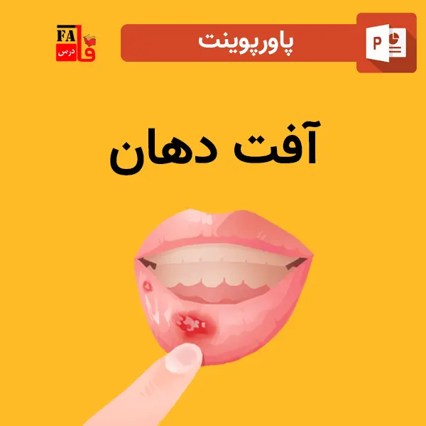 پاورپوینت آفت دهان