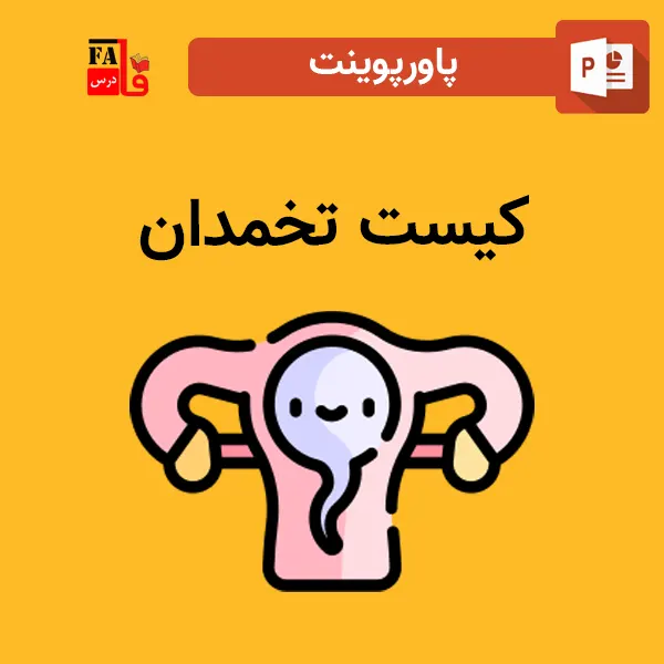 پاورپوینت کیست تخمدان