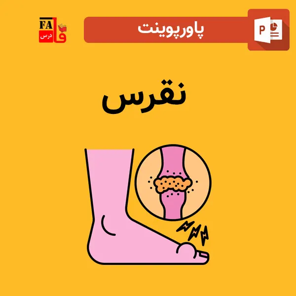 پاورپوینت نقرس