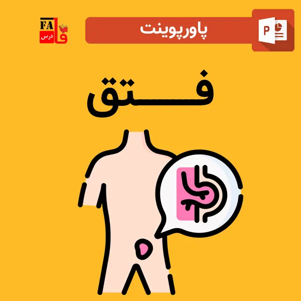 پاورپوینت فتق