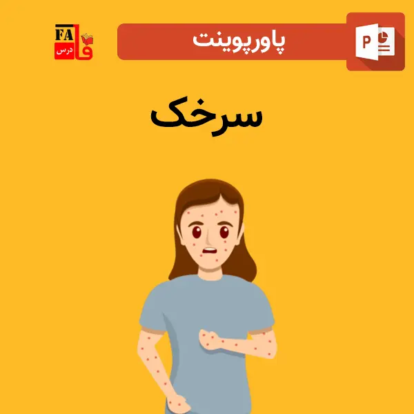 پاورپوینت سرخک