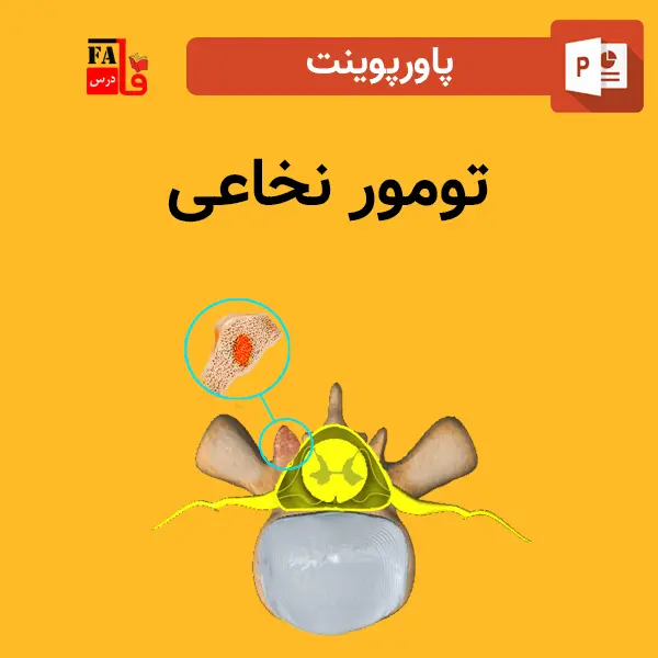 پاورپوینت تومور نخاعی
