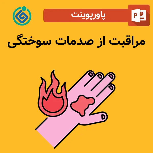 پاورپوینت مراقبت از صدمات سوختگی