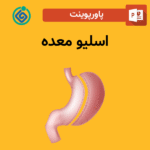 پاورپوینت اسلیو معده